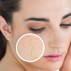 خلطات طبيعية لعلاج تشقق الجسم