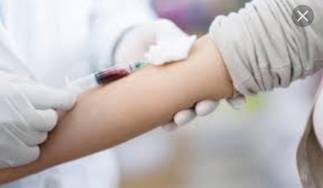 انفجار رصاصة بيد شاب اثناء عبثه بها في الرويشد.