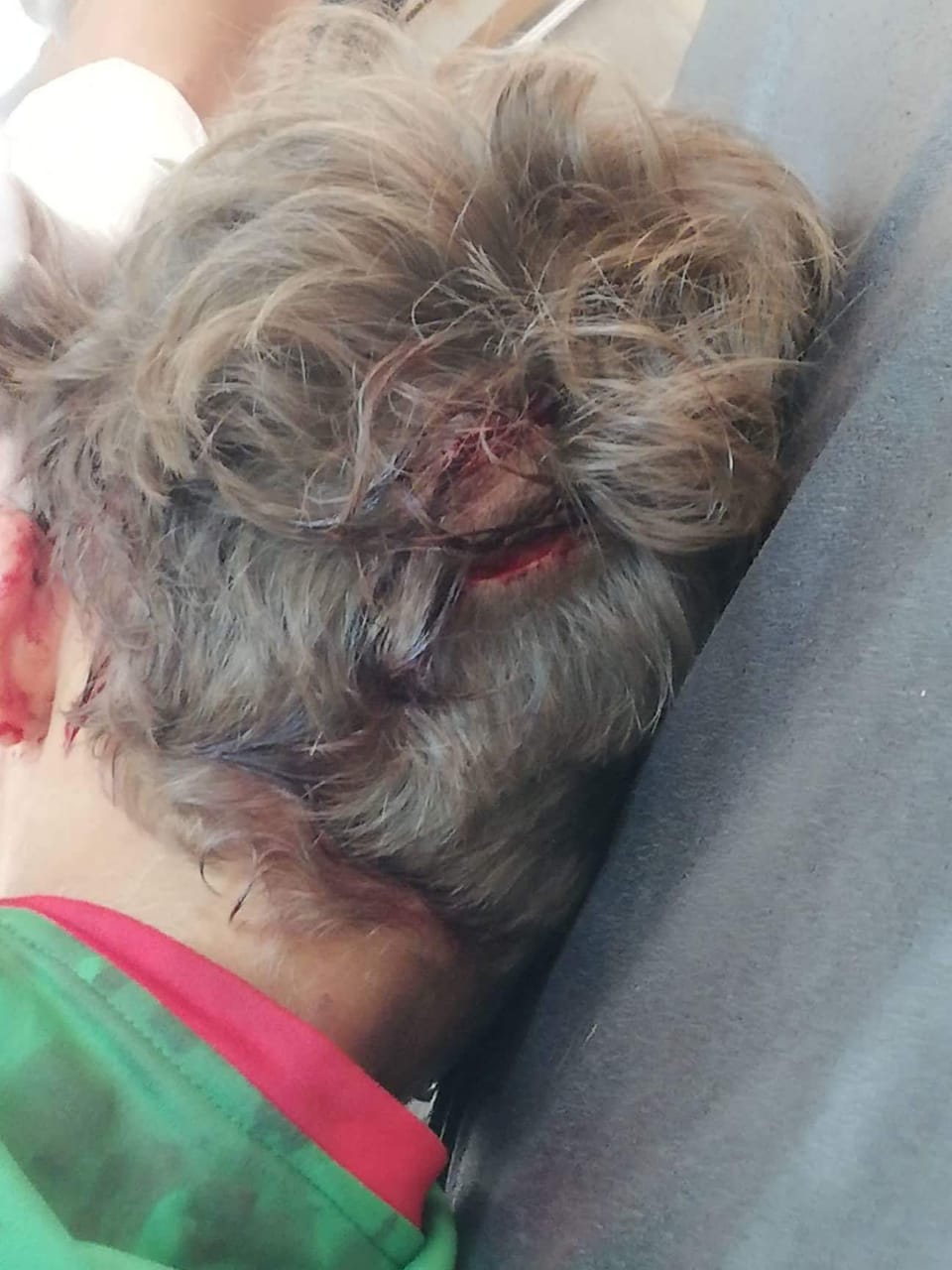 كلاب ضالة تنهش طفل في مادبا.. صور