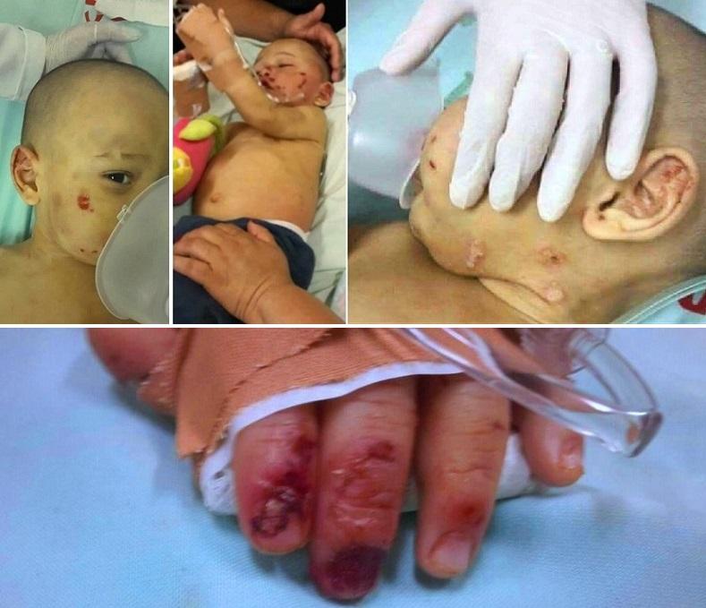 بالفيديو .. جريمة بشعة : قصة لبناني عضعض طفل و قلع أظافره وحرّق جسمه بسيجارة