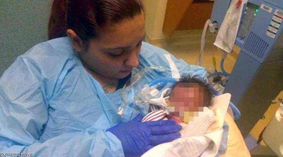 حالة ولادة نادرة تحير الأطباء.... جسد بدون جلد... تفاصيل