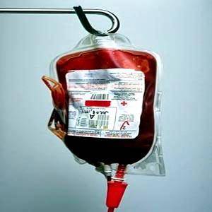 مريضة بحاجة الى  8  وحدات دم خلال 48  ساعة