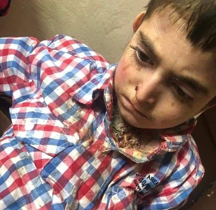 الرزاز يوعز بعلاج الطفل عبدالرحمن الذي يعاني من حاله طبية مستعصية