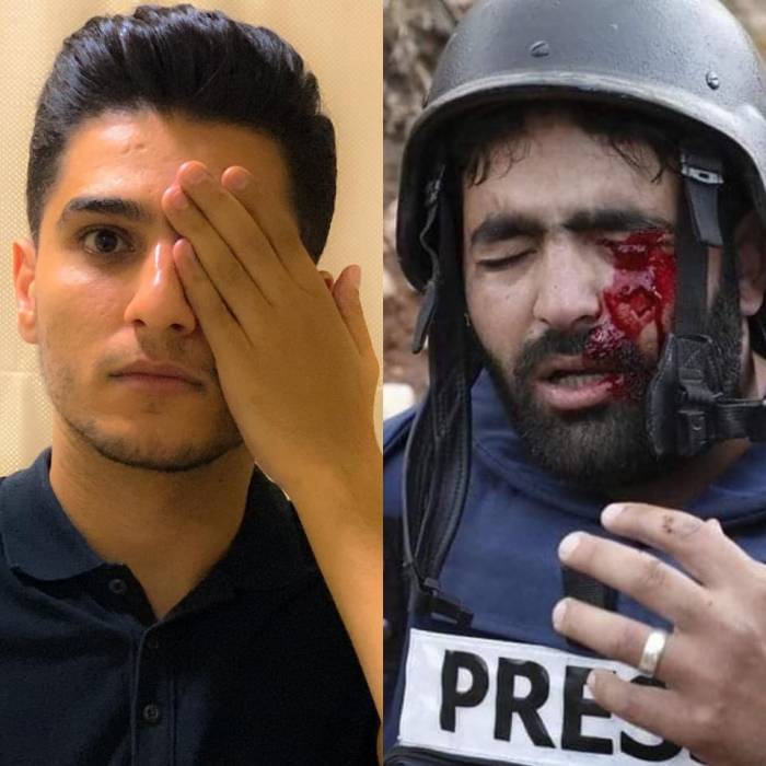 عساف الاحتلال يستهدف العين للتغطية على الجرائم التي يرتكبها بحق الشعب الفلسطيني