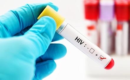 لا عدد حقيقيا لمرضى الإيدز بالأردن