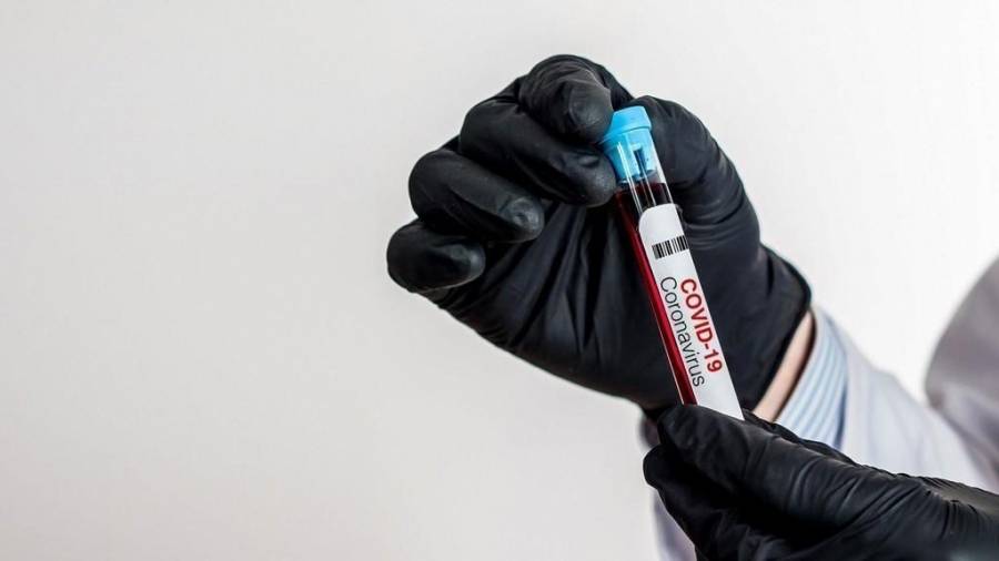 توصية بإجراء فحص كورونا في مختبرات القطاع الخاص