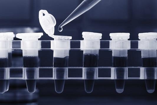 70 دينارا كلفة فحص كورونا بمختبرين خاصين