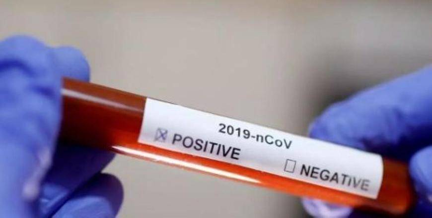 ارتفاع عدد حالات الإصابة بالفيروس في الأردن إلى 33