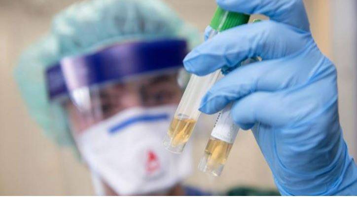 ترتفع اصابات كورونا في الاردن الى 48