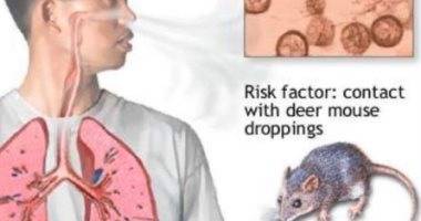تسجيل أول وفاة بفيروس هانتا Hantavirus الصين
