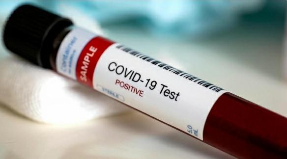 الهياجنة: النتائج المخبرية الاولى لـ 300 عينة اخذت من مخالطين في اربد تدعو للتفاؤل