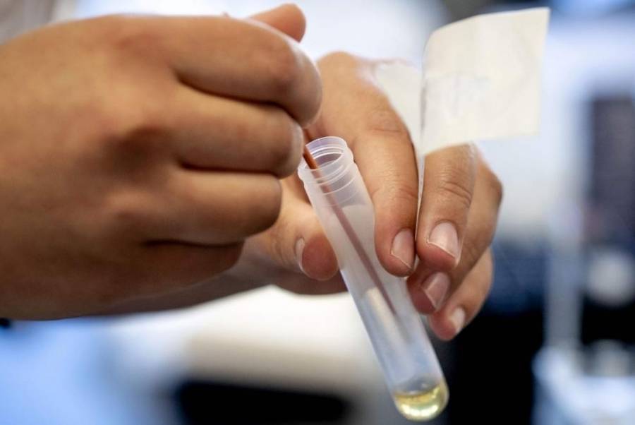 وكالة الأدوية الأوروبية: لقاح «كورونا» ليس قبل عام