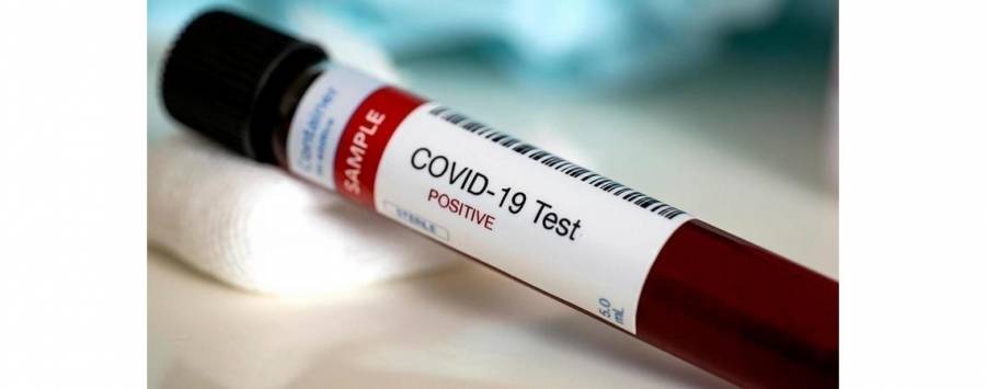 سحب عينات من سكان ببلدة كريمة خالطوا مصاب من عجلون