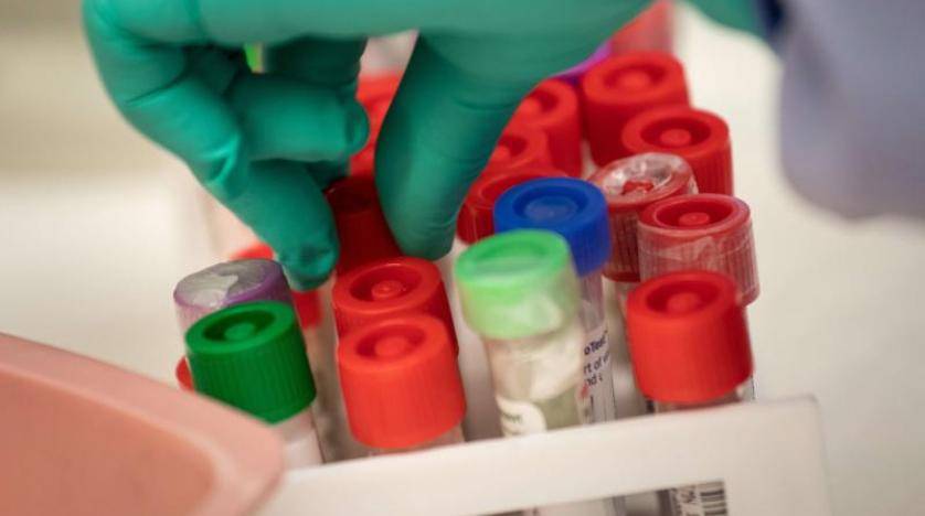 جميع نتائج عينات مخالطي متوفى السلط سلبية