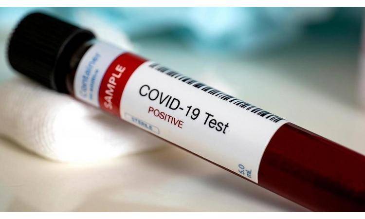 الهياجنة: يجب انخفاض الحالات أسبوعياً لنرى الفرق