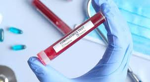 عجلون :سحب 74 عينة لمخالطي مصابين