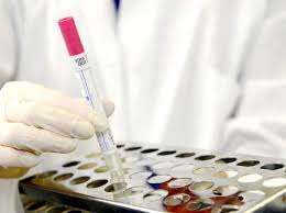 20 فريقا استقصائيا وبائيا بالعقبة لسحب 500 عينة عشوائية