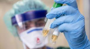 جرش: 150 عينة عشوائية نتائجها سلبية