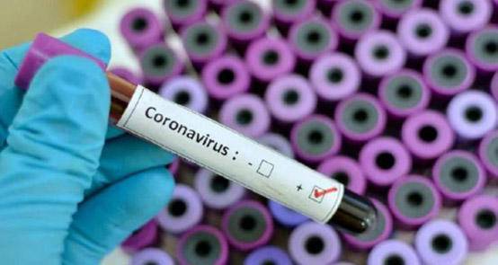 84 عينة سلبية لمخالطي سائق إربد