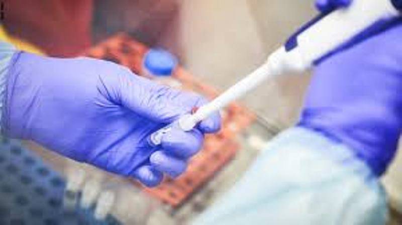 34 عينة منتقاة لكوادر وعائلات سائقي شحن نتائج فحوصاتها سلبية