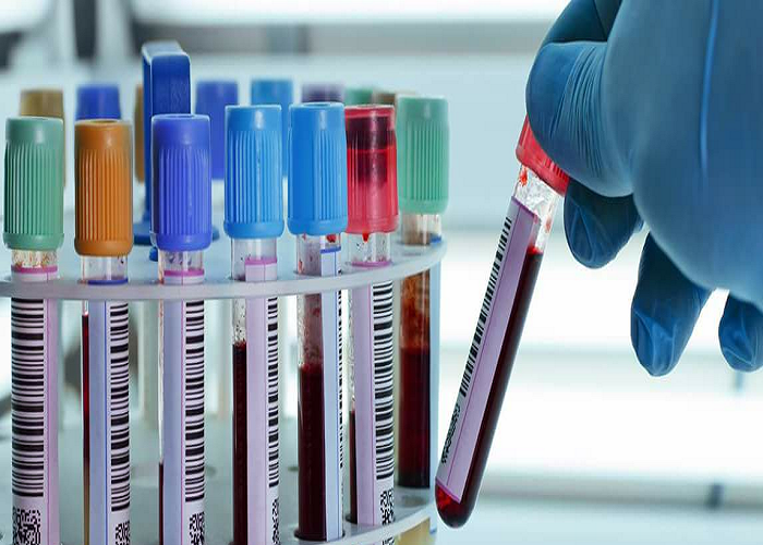 الكرك: سحب 6 عينات من مخالطي مخالط المفرق