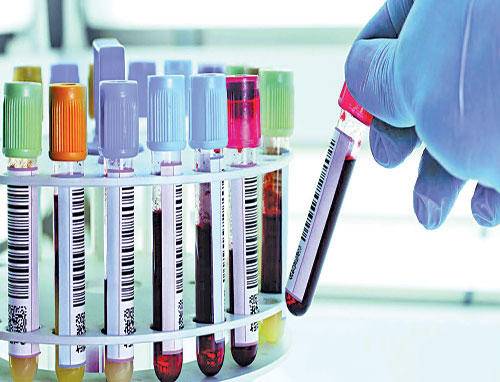 عزيمة الخناصري تتمدد .. موزع بوظة لمحال في جرش ثبتت إصابته بالكورونا وفرق التقصي الوبائي تبدأ بأخذ العينات