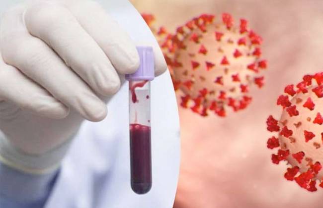 الغزو: نتائج سلبية لـ 50 عينة في اربد والإصابات بحالة مستقرة