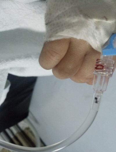 الديوان الملكي يتكفل بعلاج طفل مصري