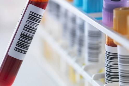 بلدية اربد فحص 200 عينة عشوائية للموظفين