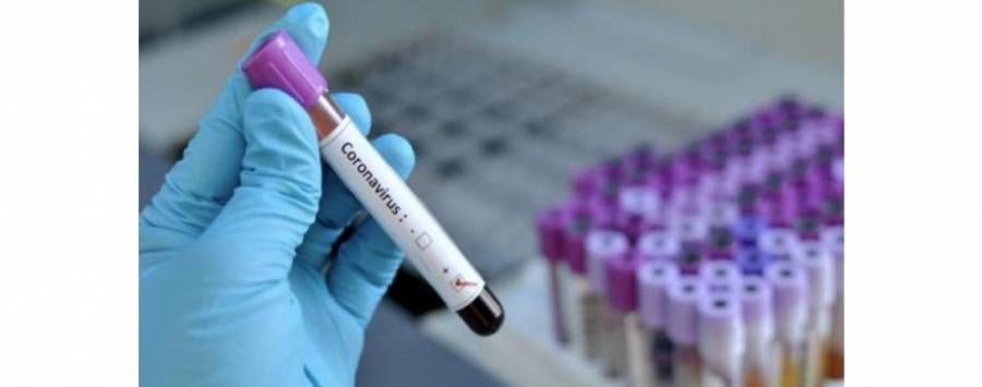 نتائج فحص عينات مخالطي ممرضة الرمثا سلبية باستثناء زوجها