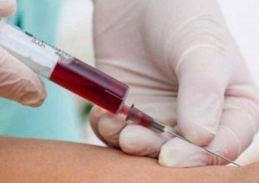 الرمثا ظهور نتائج فحوصات لمخالطي ممرضة