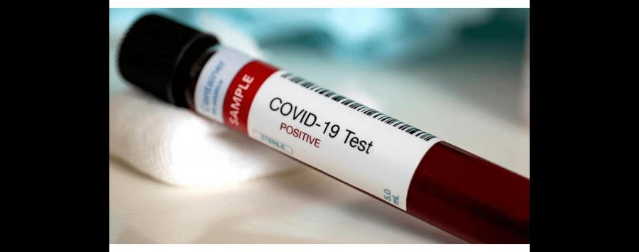 العزب: عزل حي سكني لمصابة بكورونا في دير علا واخذ ٢٠٠ عينة لمخالطيها