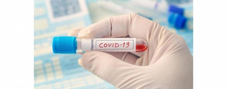 ظهور نتائج 70 عينة لمخالطي مصابة دير علا وترجيح مصدر الإصابة