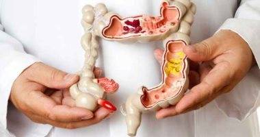 اعراض التهاب القولون التقرحي وأسباب الإصابة به