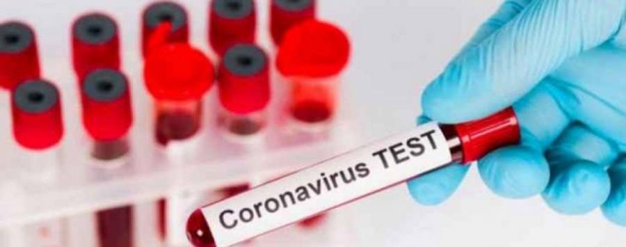 مدير البشير: عينة فحص كورونا الاولية لطبيب في المستشفى إيجابية