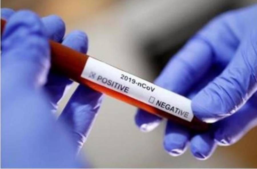 تعرف على نتائج عينات مستشفى البشير