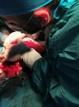 إستئصال ورم خبيث بزنة (٤٧٠٠) غرام من ثدي سيدة بمستشفى الحسين السلط