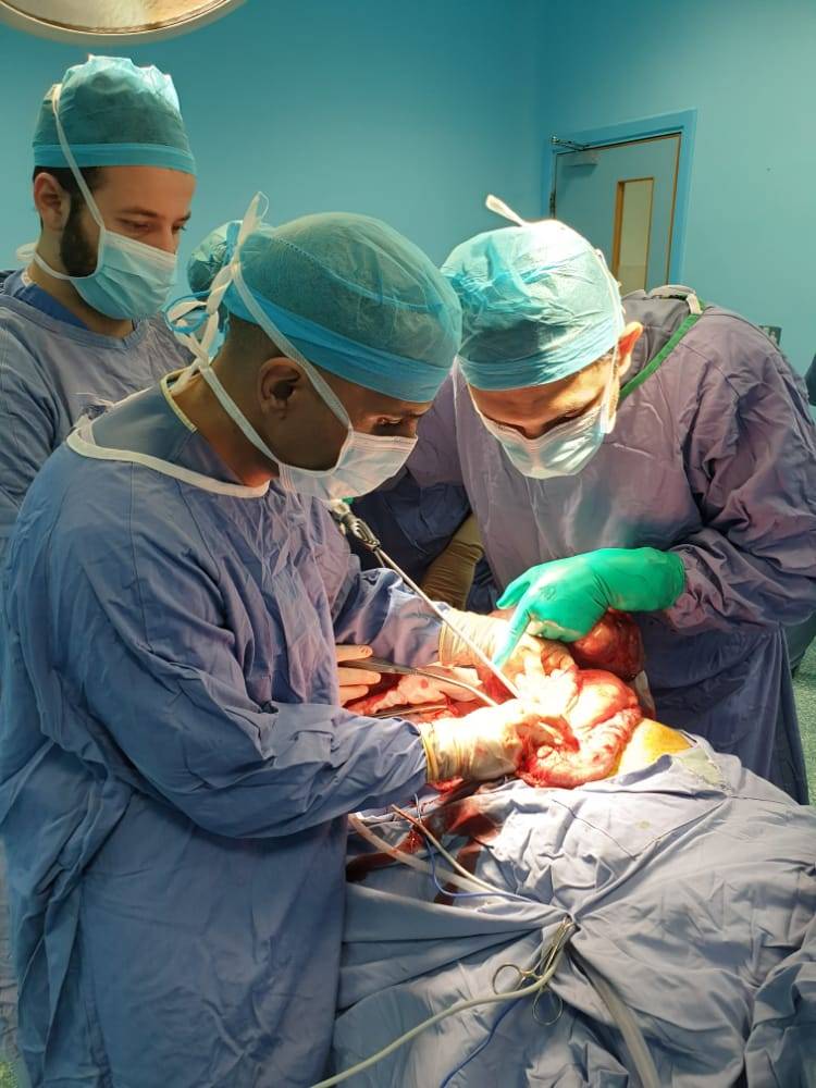 استئصال ورم كبير في البطن بعملية نوعية ومعقدة لمريض بمستشفى المؤسس (صور)