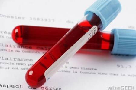 نتائج 84 عينة لمخالطي مصاب الرمثا سلبية