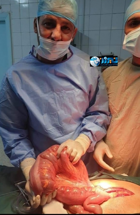 عملية جراحية نوعية في مستشفى المفرق الحكومي.