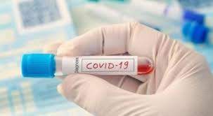 السعد : اصابة جديدة في مدينة الشجرة وعزل منزلين وسحب ١٠٠ عينة