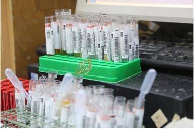 جامعة اليرموك تكشف عن نتيجة فحص كورونا لأحد موظفيها