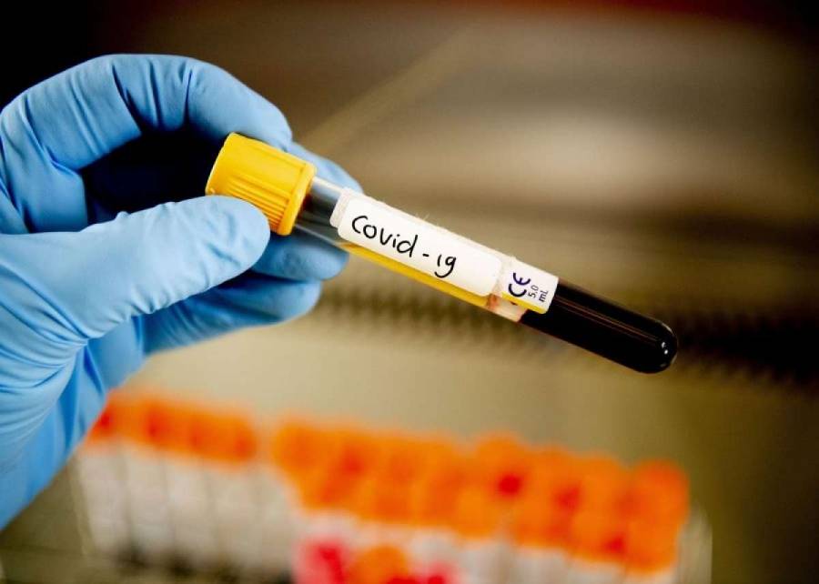 خلية الأزمة: نتوقع صعوبة التعامل مع إصابات كورونا إذا تجاوزت 5 آلاف يوميا في المملكة !