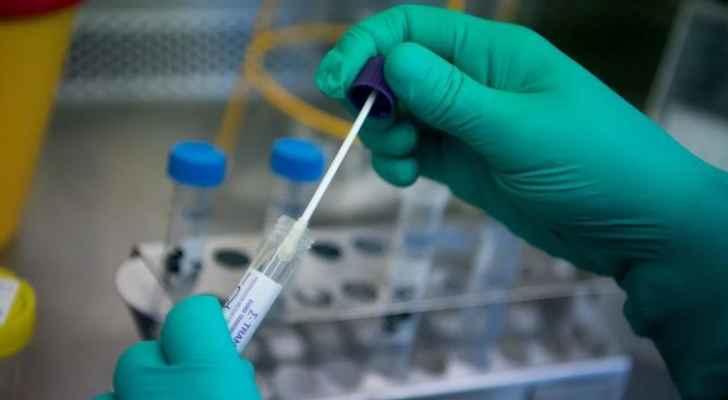 حوسبة جميع فحوصات pcr في الأردن