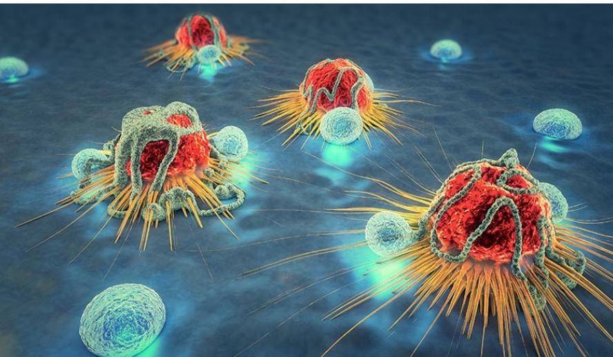 اختبارات جديدة لمرضى السرطان... تفاصيل