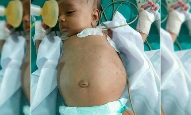 رضيعة بعمر 7 أيام تلد جنيناً في مصر!