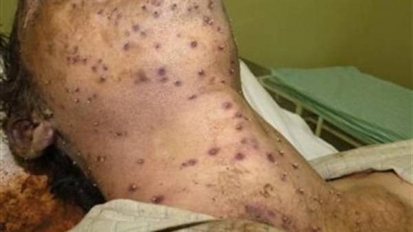 سرب من النحل يهاجم رجلا ويقتله فى ولاية تكساس الأمريكية