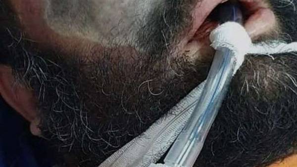 الصحة: الفطر الأسود غير معدِ .. ونتابع كل تفاصيله