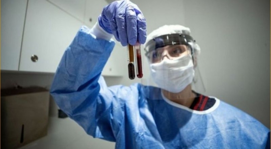 12085 إصابة جديدة و 92 حالة وفاة بفيروس كورونا في البرازيل