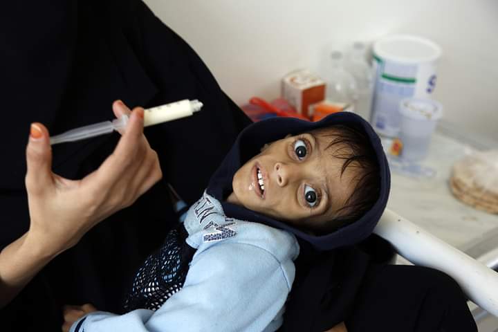 شبح المجاعة يخنق براءة الأطفال في اليمن